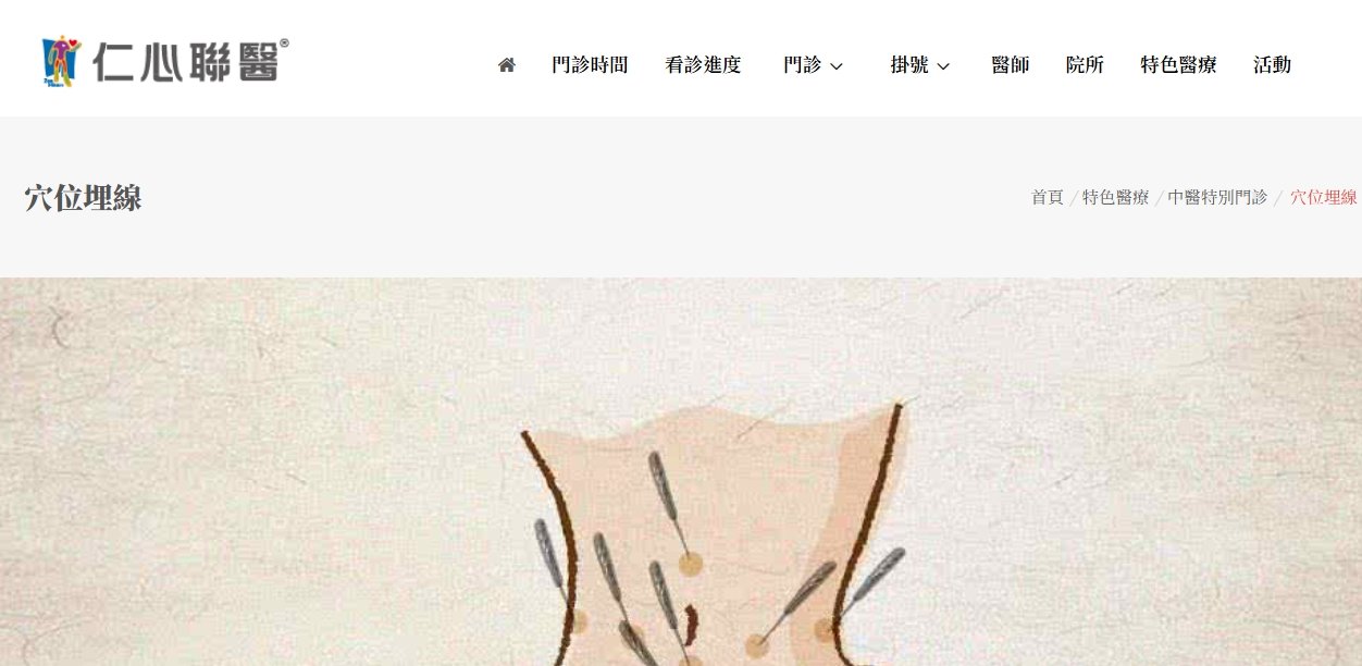 仁心聯醫-穴位埋線