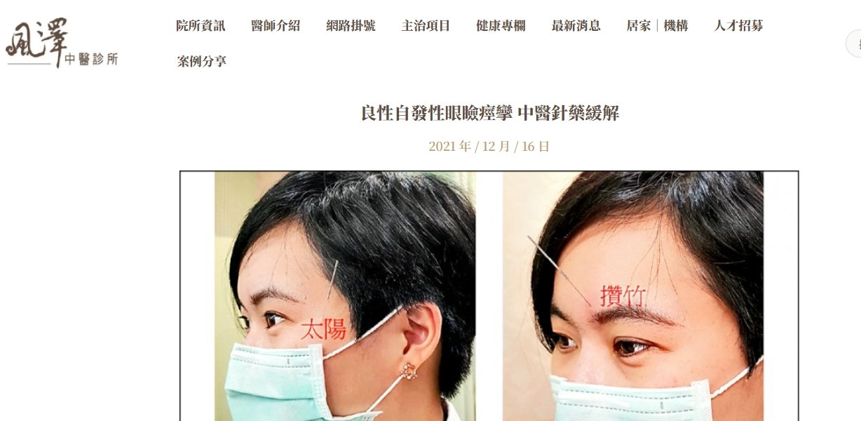 風澤中醫診所-良性自發性眼瞼痙攣 中醫針藥緩解
